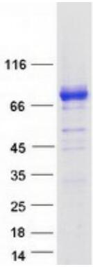 Coomassie blue staining of purified SPHK2 protein.